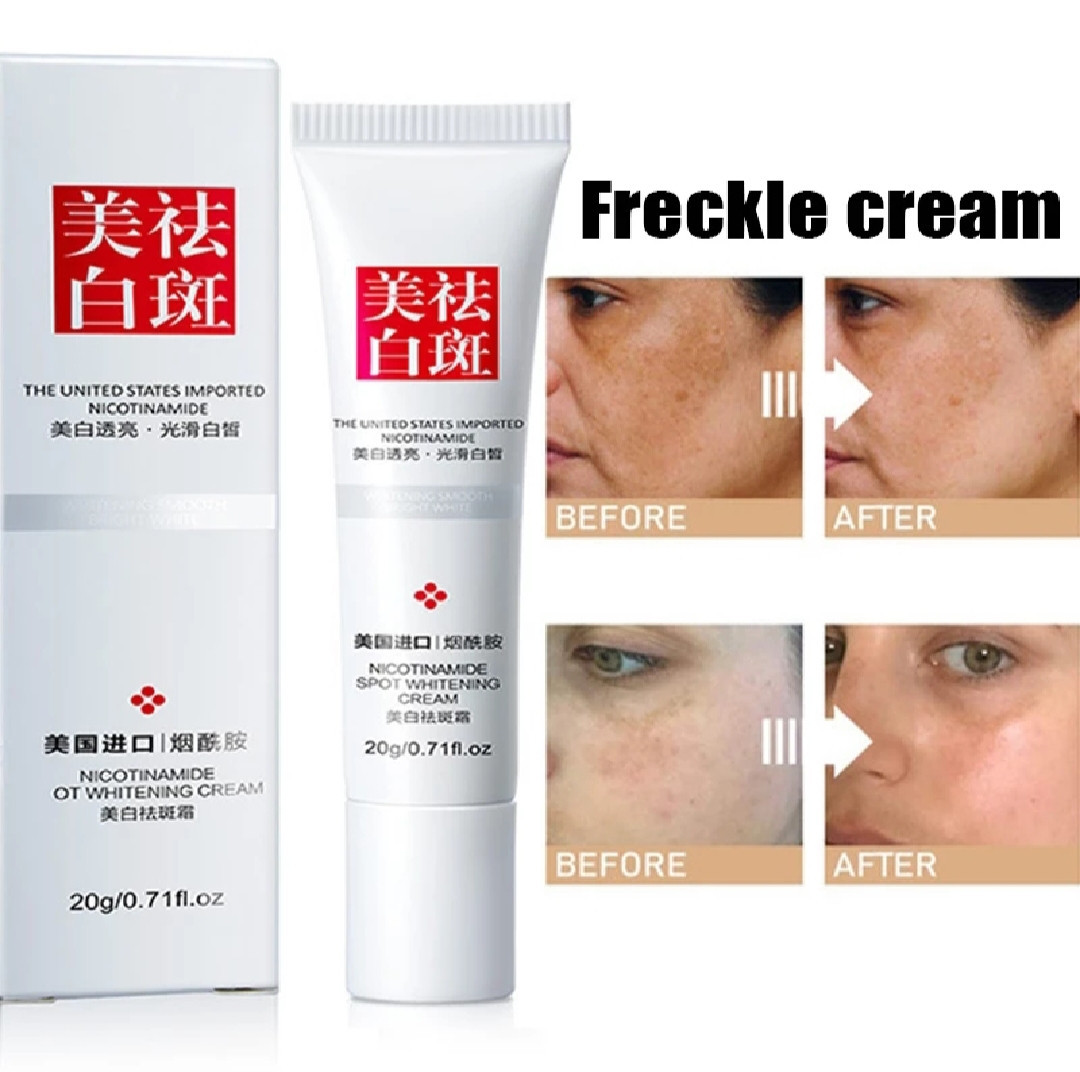 Freckle Removal Cream Whitening Anti Melasma Removal and Dark Spots Cream Effective Acne Scars 20g